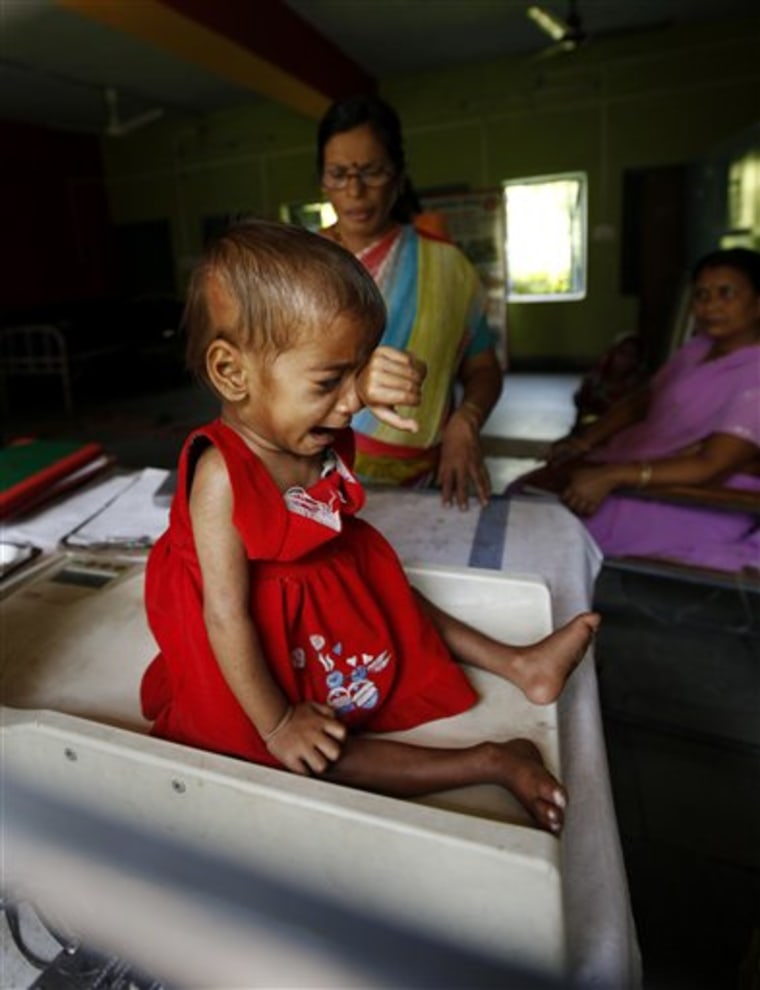 In this photo taken April 13, 21-month-old Sania cries as she is weighed at just 11 pounds on a scale after eating a meal at a ward for malnourished children at a government hospital in Morena in the Central Indian State of Madhya Pradesh.
